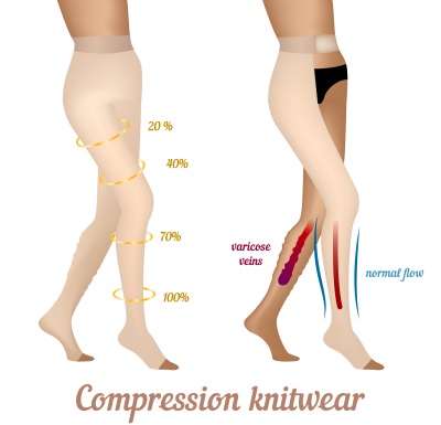 Compression Pantyhose Varicose Veins