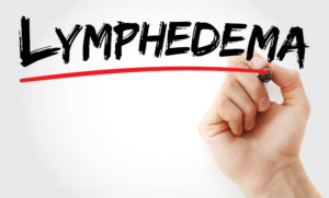 Lymphedema-Handwritten-Sign